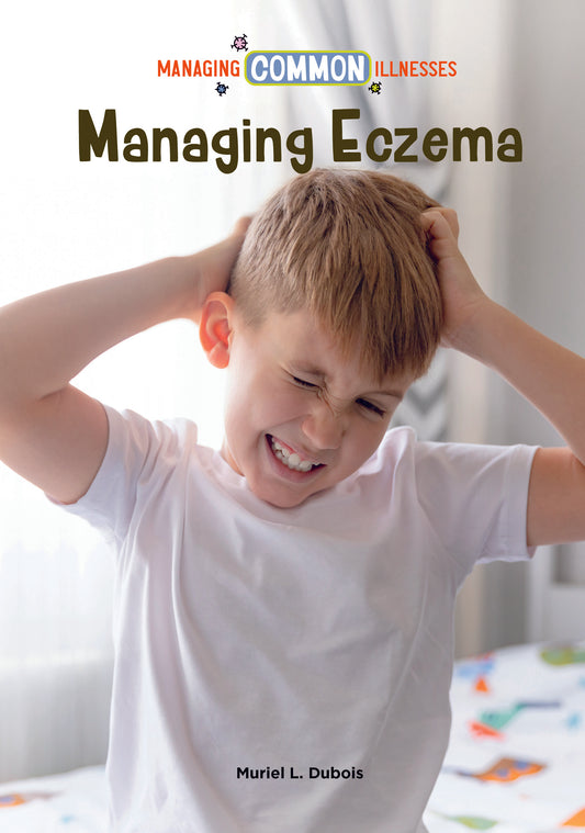 Managing Eczema